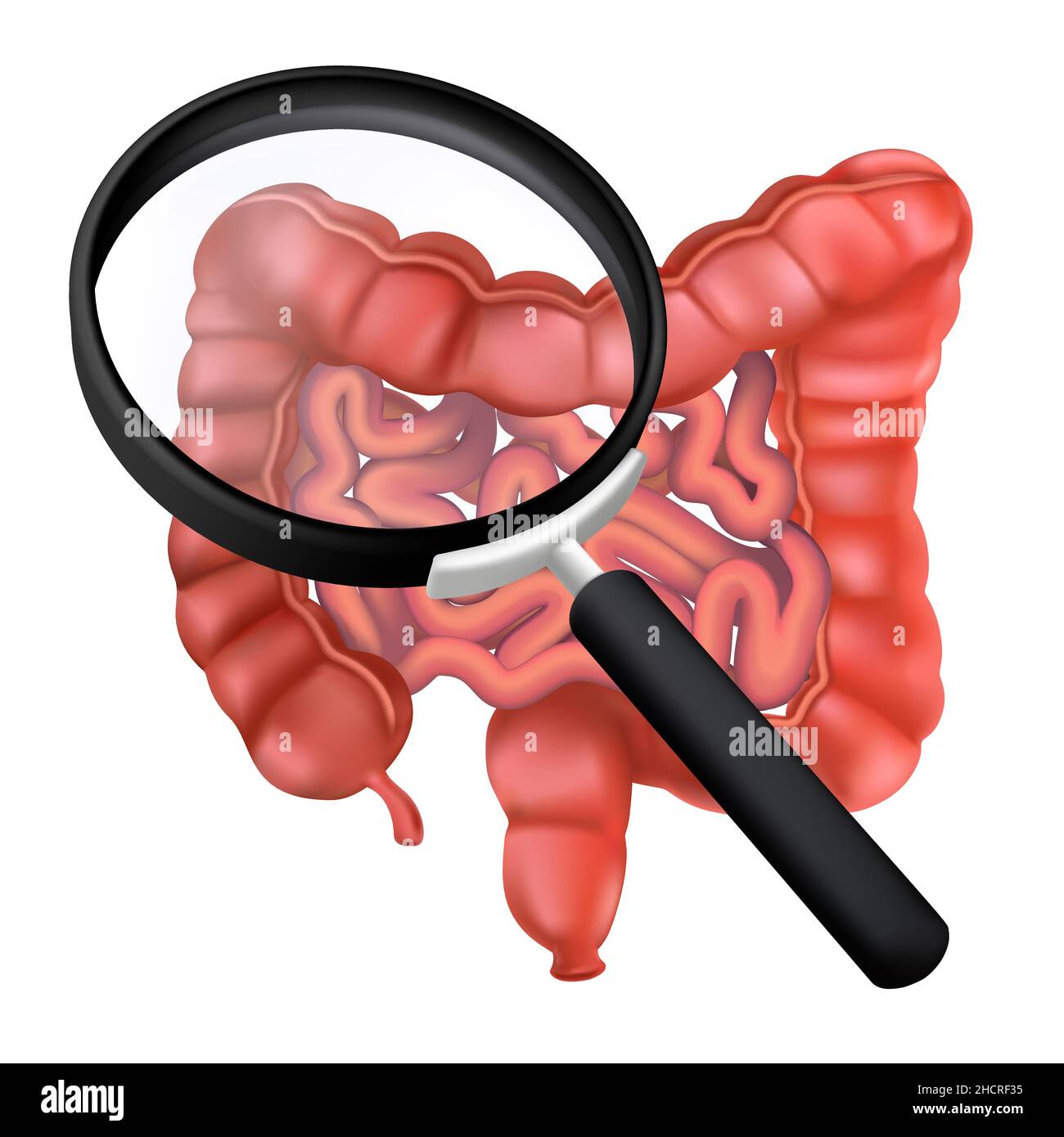 Realistische menschliche Eingeweide unter einer Lupe. 3D Vektordarstellung des Dickdarms. Untersuchungen des Magen-Darm-Traktes. Anatomisches Konzept von Stock Vektor