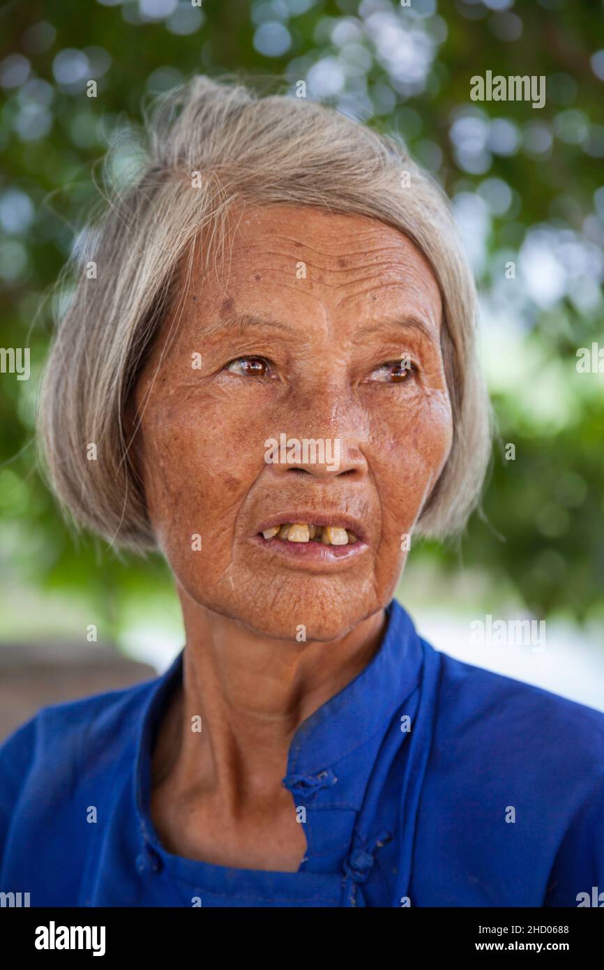 Eine alte Frau mit schiefen Zähnen im ländlichen Dorf Yiling, Nanning, Guangxi, China. Stockfoto