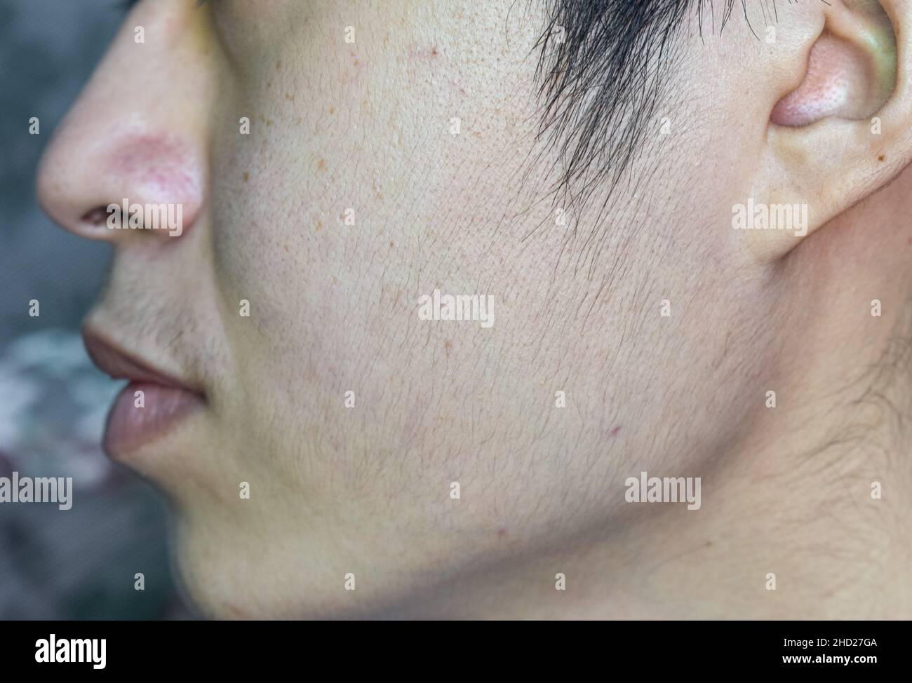 Schöne Haut mit breiten Poren im behaarten Gesicht von südostasiatischem, Myanmar oder koreanischem erwachsenen jungen Mann. Stockfoto Schöne Haut mit breiten Poren im behaarten Gesicht von südostasiatischem, Myanmar oder koreanischem erwachsenen jungen Mann. Stockfoto
