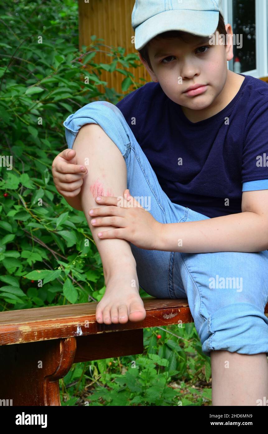 Nahaufnahme des verletzten jungen Kindes Knie, nachdem er auf dem Bürgersteig gefallen, das Bein des Jungen schmerzt. Blutergüsse, Kratzer nach Sommerspaziergängen oder Sport Stockfoto