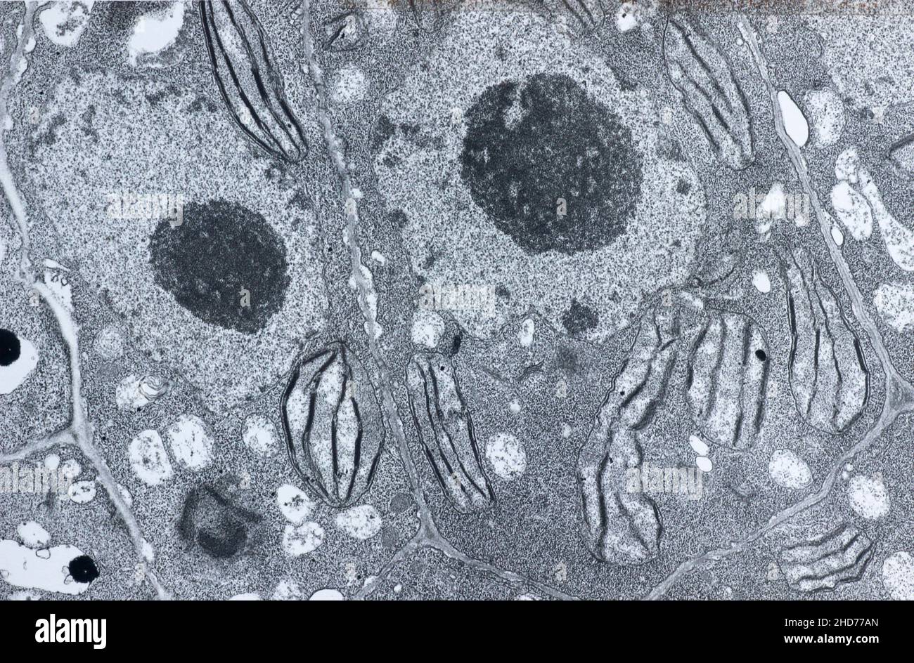 Elektronenmikroskopie einer vegetalen Zelle, die Chloroplast, Zellkern, Nukleol und Zellwände zeigt. Stockfoto