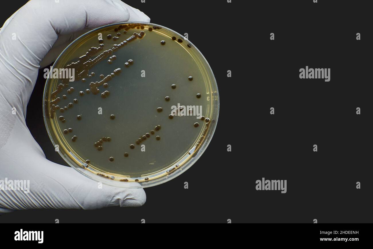 Schwarze Bakterien besiedeln selektive Medien auf Agar-Platten in Petrischalen Stockfoto