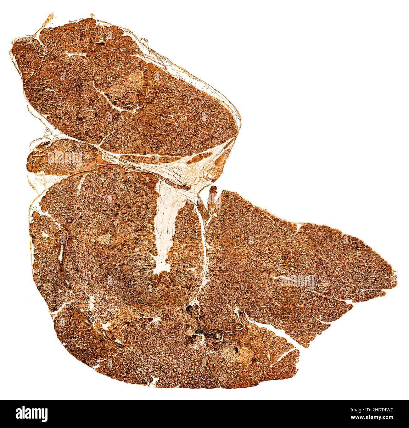 Querschnitt, Mikroskopie, Bauchspeicheldrüse, Querschnitt, Mikroskopien Stockfoto