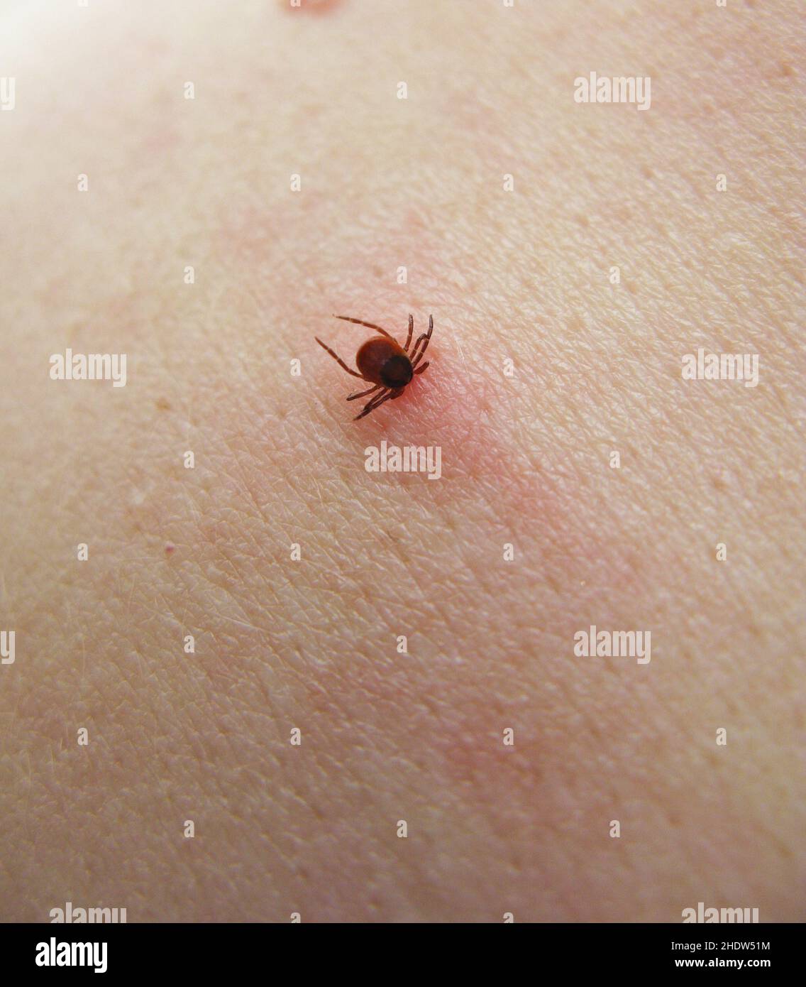 Tick, ixodes ricinus, Zecken Stockfoto