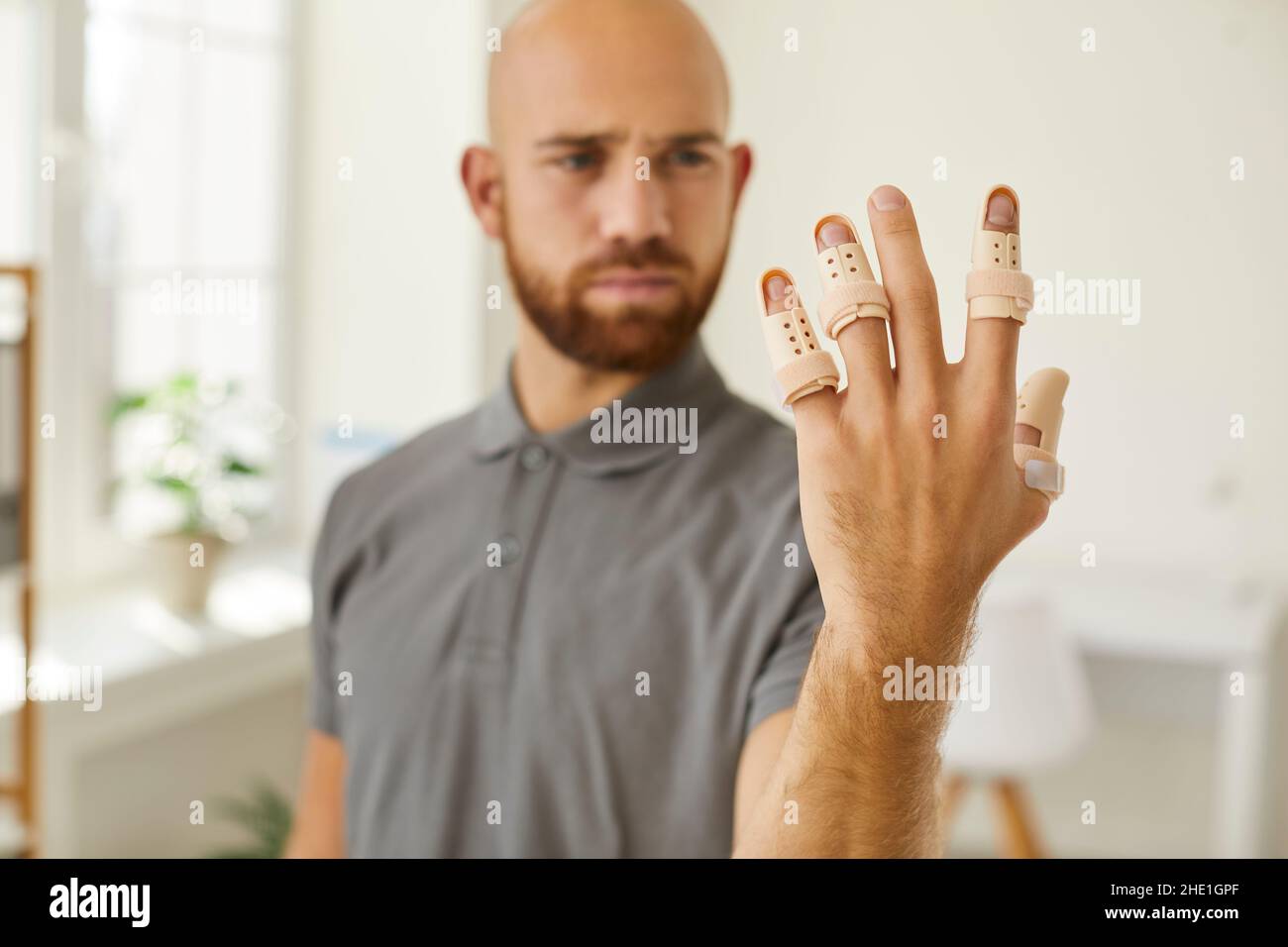 Orthopädische Geräte wie Kunststoffschienen an gebrochenen Fingern der linken Hand des Mannes. Stockfoto