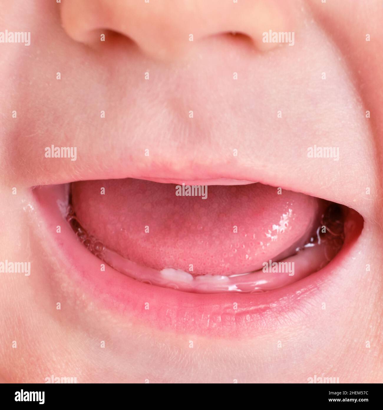 Die Zähne zahnen beim Säugling, der Mund ist aus nächster Nähe. Zunge und Unterzähne