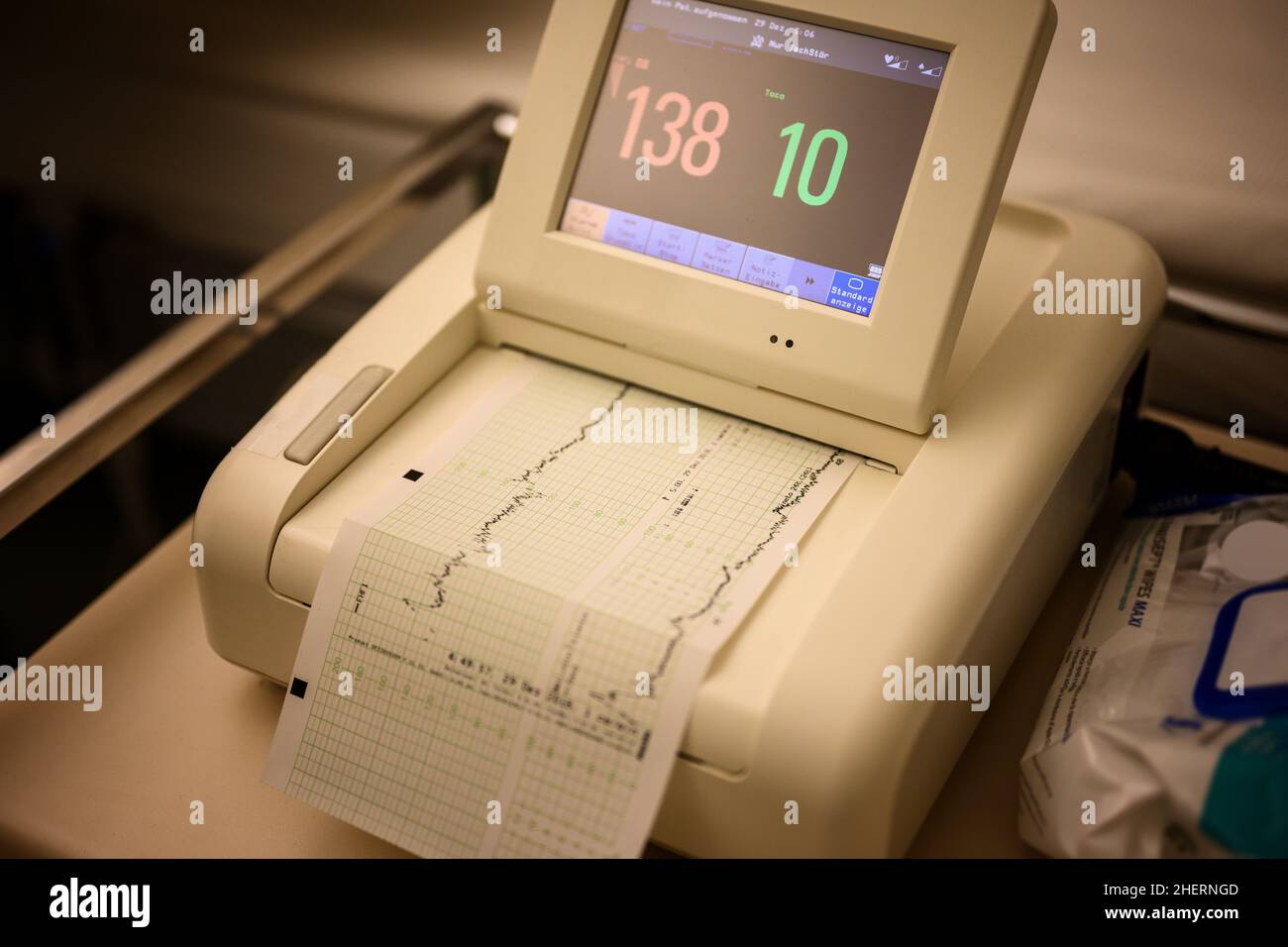 Kardiotokographie-Gerät des Krankenhauses mit Monitor und Diagramm auf Papier Stockfoto