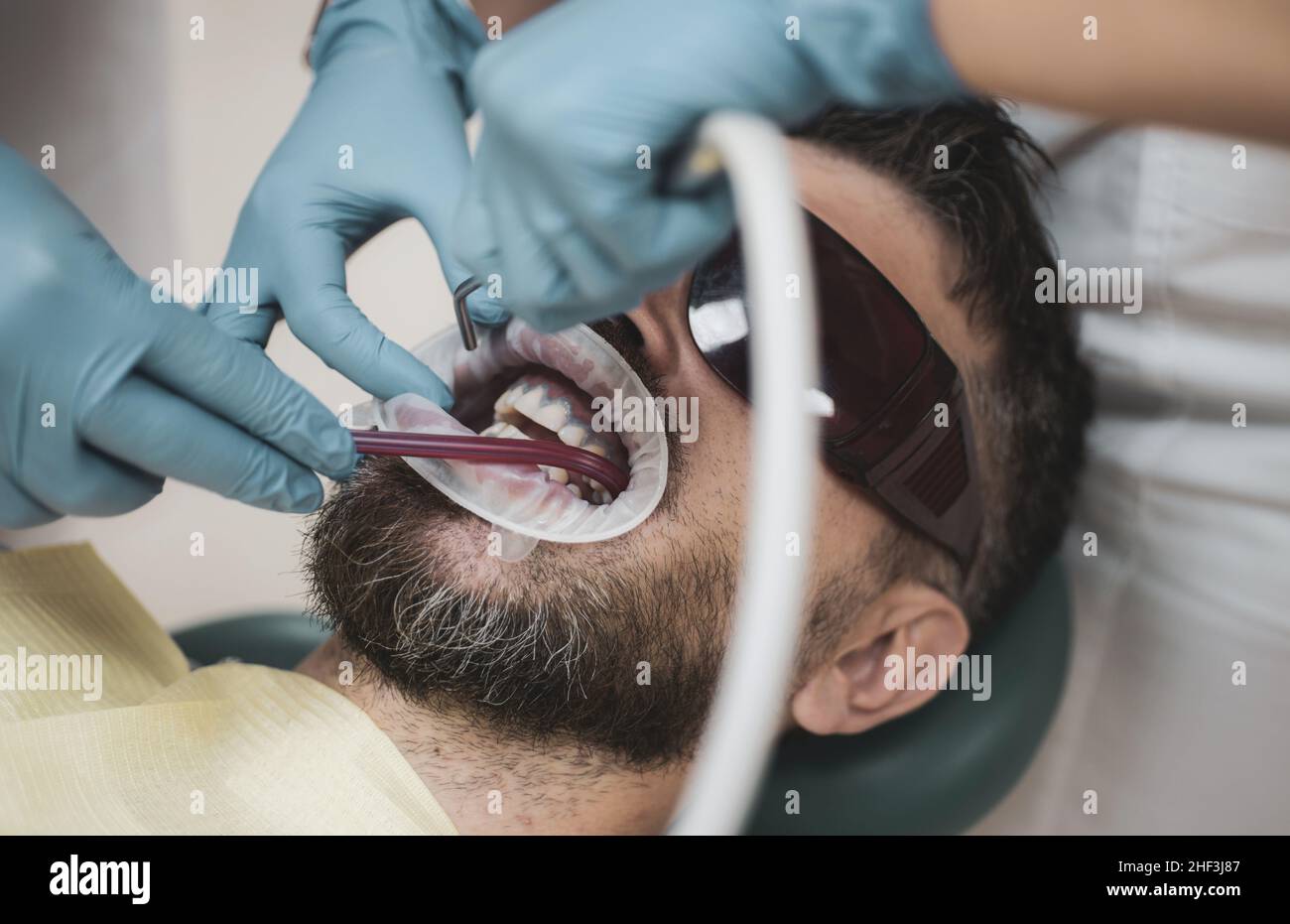 Gutaussehender Mann im Zahnarztbüro. Weibliche Zahnärztin, die die Zähne des Patienten mit Spiegel in einer modernen Zahnklinik überprüft. Untersuchung des jungen Mannes durch den Zahnarzt auf Licht Stockfoto