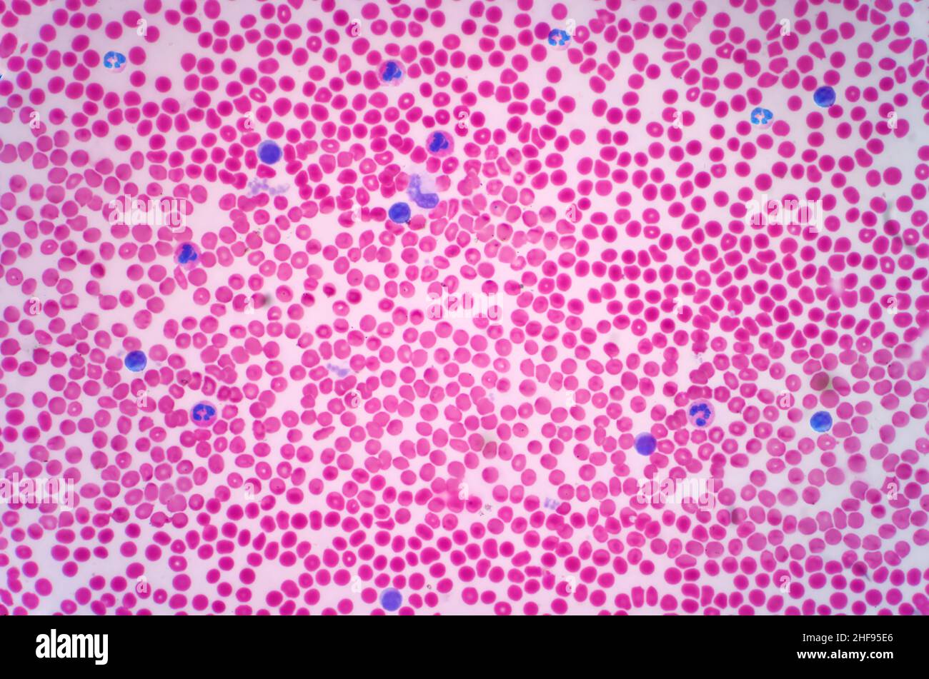 Menschliche Blutzellen, leichte Mikrograph Stockfoto