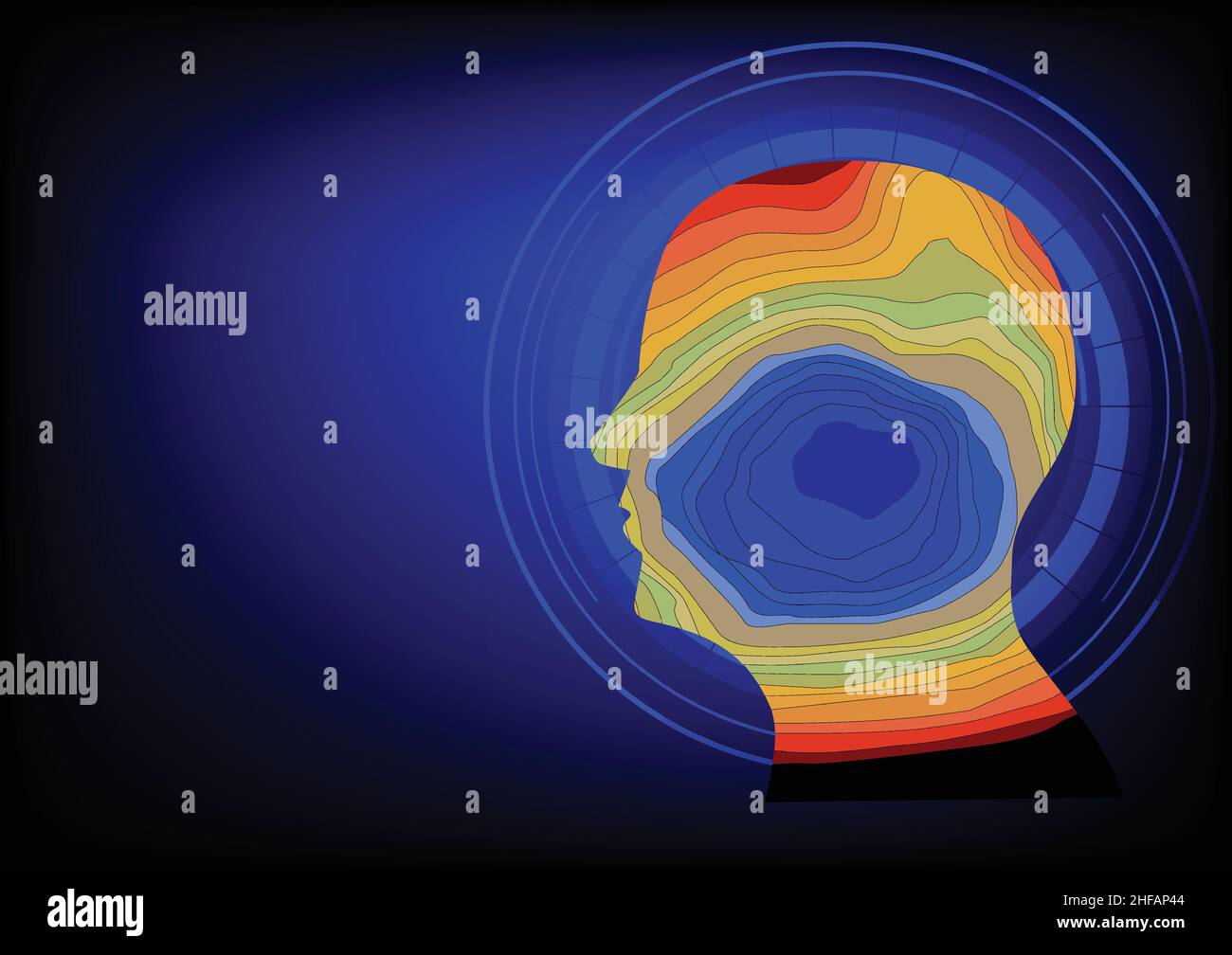 Quellenbildgebung des menschlichen epileptischen Fokus im zeitlichen Bereich. Illustration eines mehrfarbigen Bandes im menschlichen Kopf, das verschiedene Polarität von Elektrica darstellt Stock Vektor