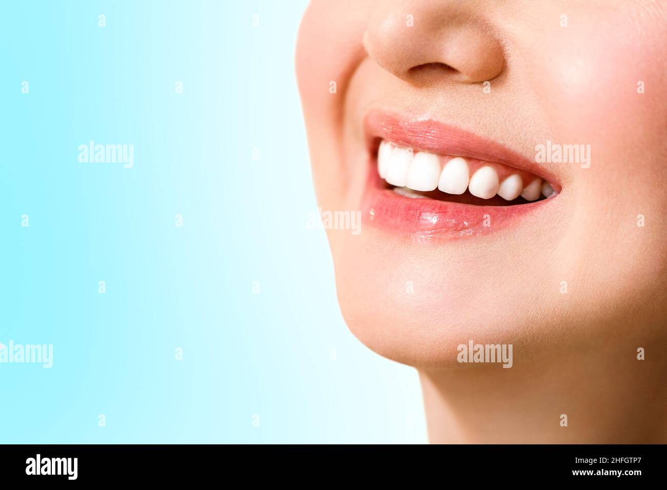 Schönes weibliches Lächeln nach Zahnaufhellung Verfahren. Zahnpflege. Zahnmedizin Konzept. Auf blauem Hintergrund. Stockfoto