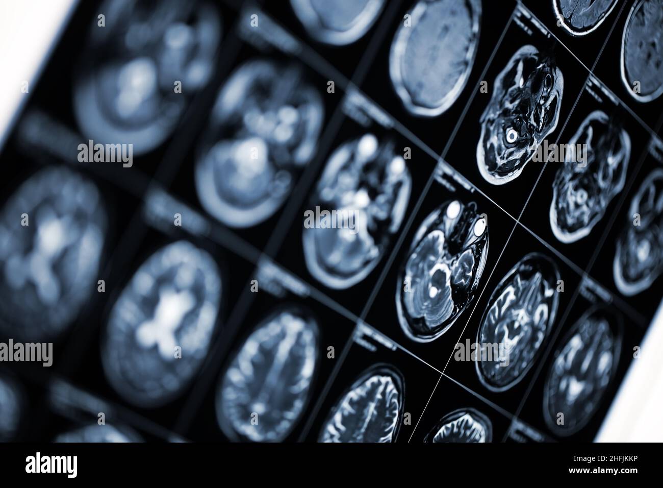 Medizinischer Hintergrund mit MRI-Scan-Bild des menschlichen Kopfes. Stockfoto
