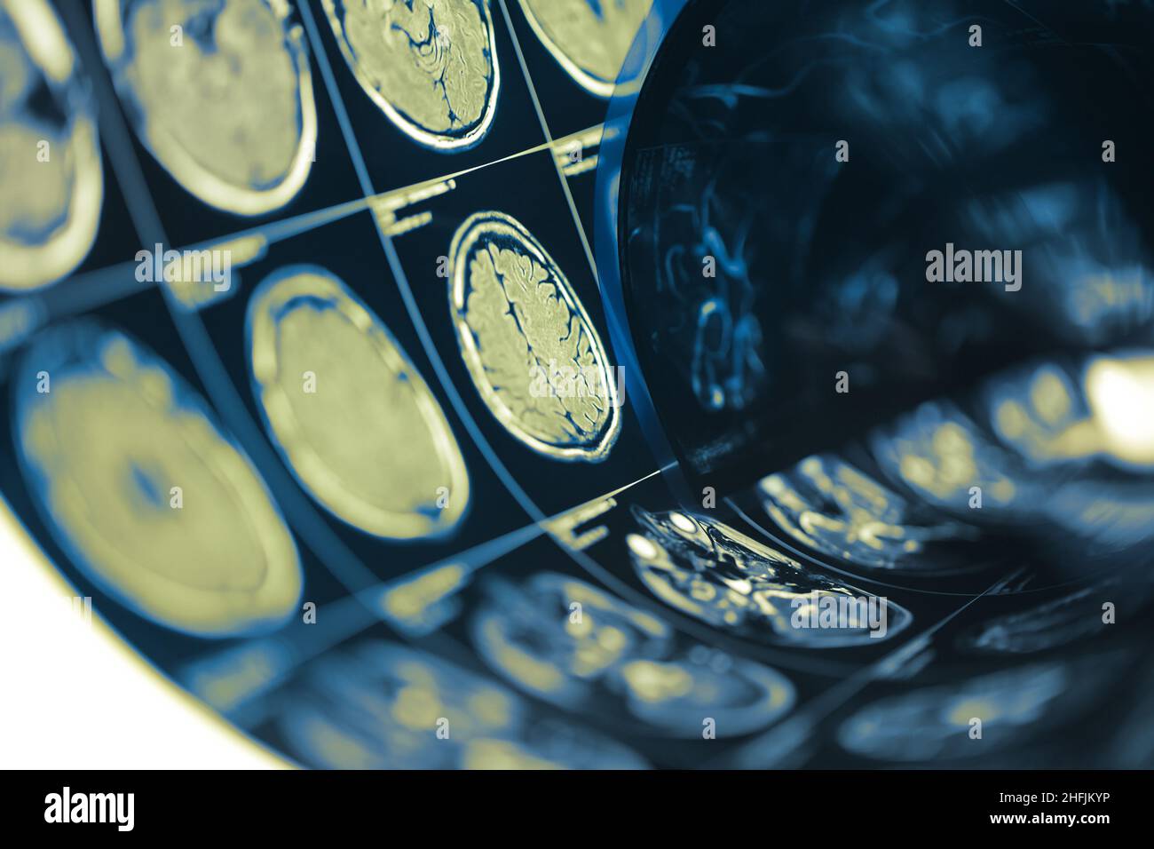Human Brain Scan Testfilm gefaltet in einer Rolle, medizinischen Hintergrund mit Platz für Ihr Design. Stockfoto