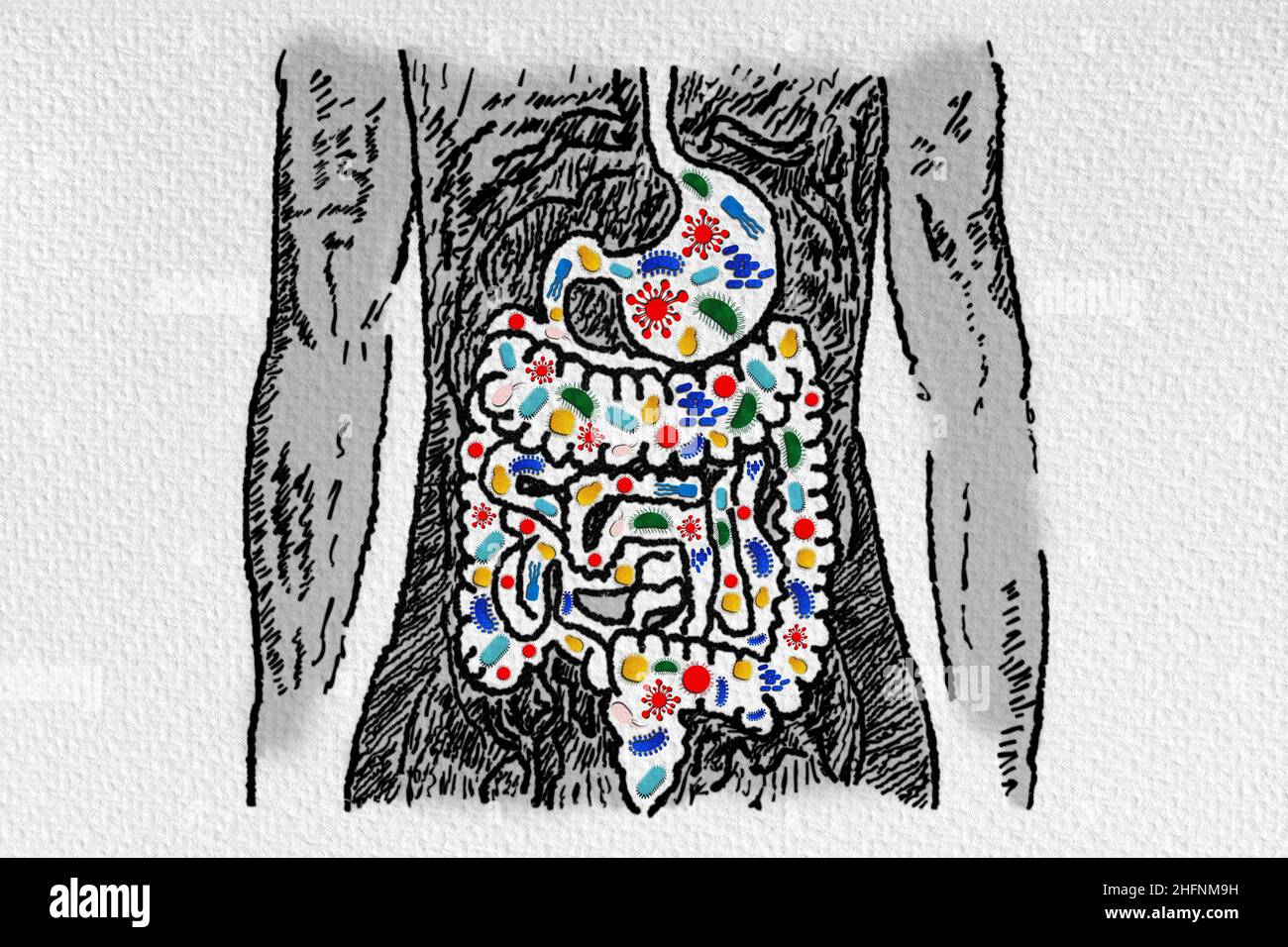 Darmmikrobiom und Probiotika - Assoziation mit gastrointestinalen Erkrankungen - Leaky gut - Dysbiose - kleines intestinales bakterielles Überwachstum - Conceptua Stockfoto