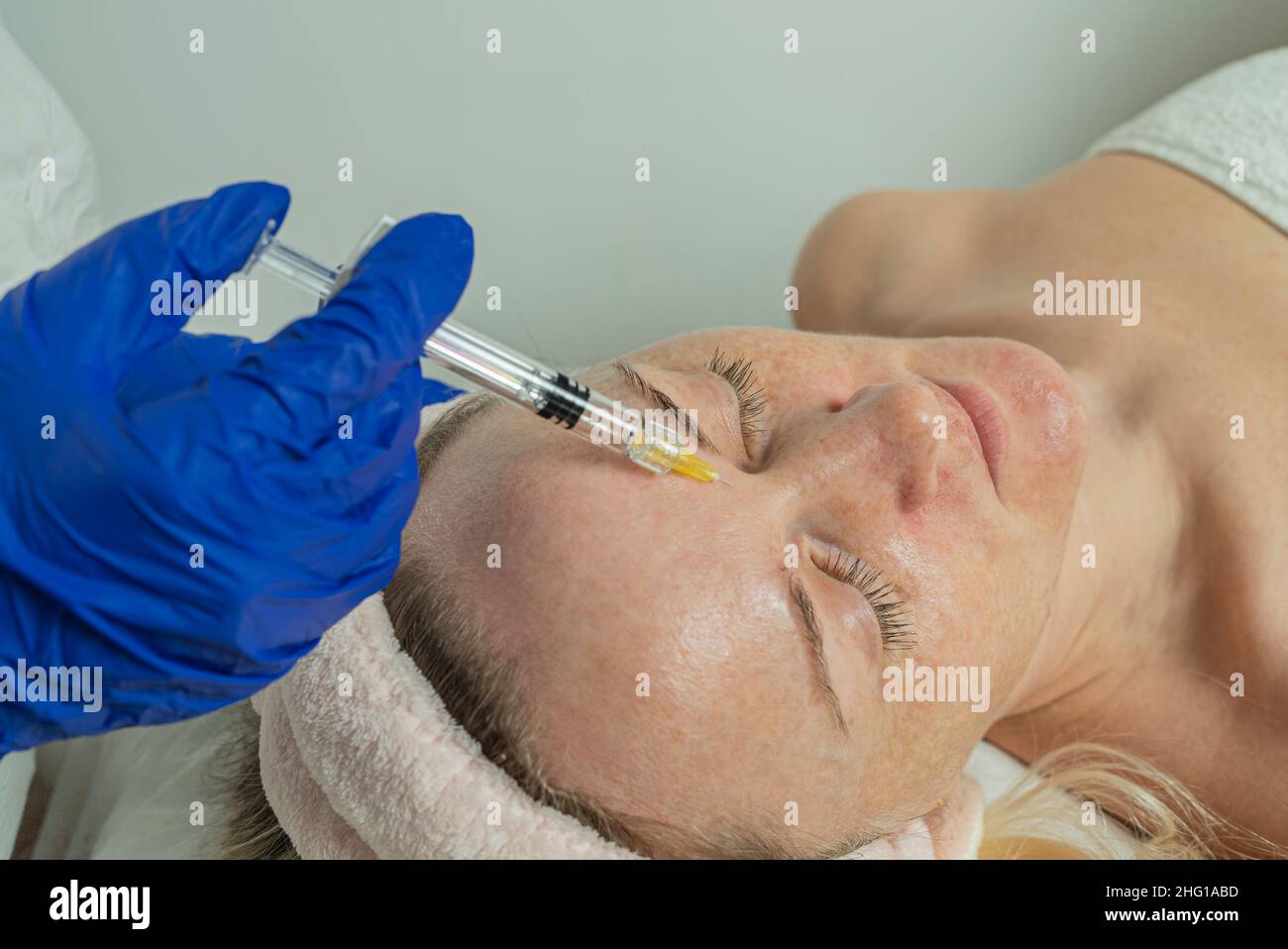 Nahaufnahme eines zugeschnittenen Bildes von den Händen eines Arztes, der eine Mesotherapie mit einer schönen Frau im Gesicht macht Stockfoto
