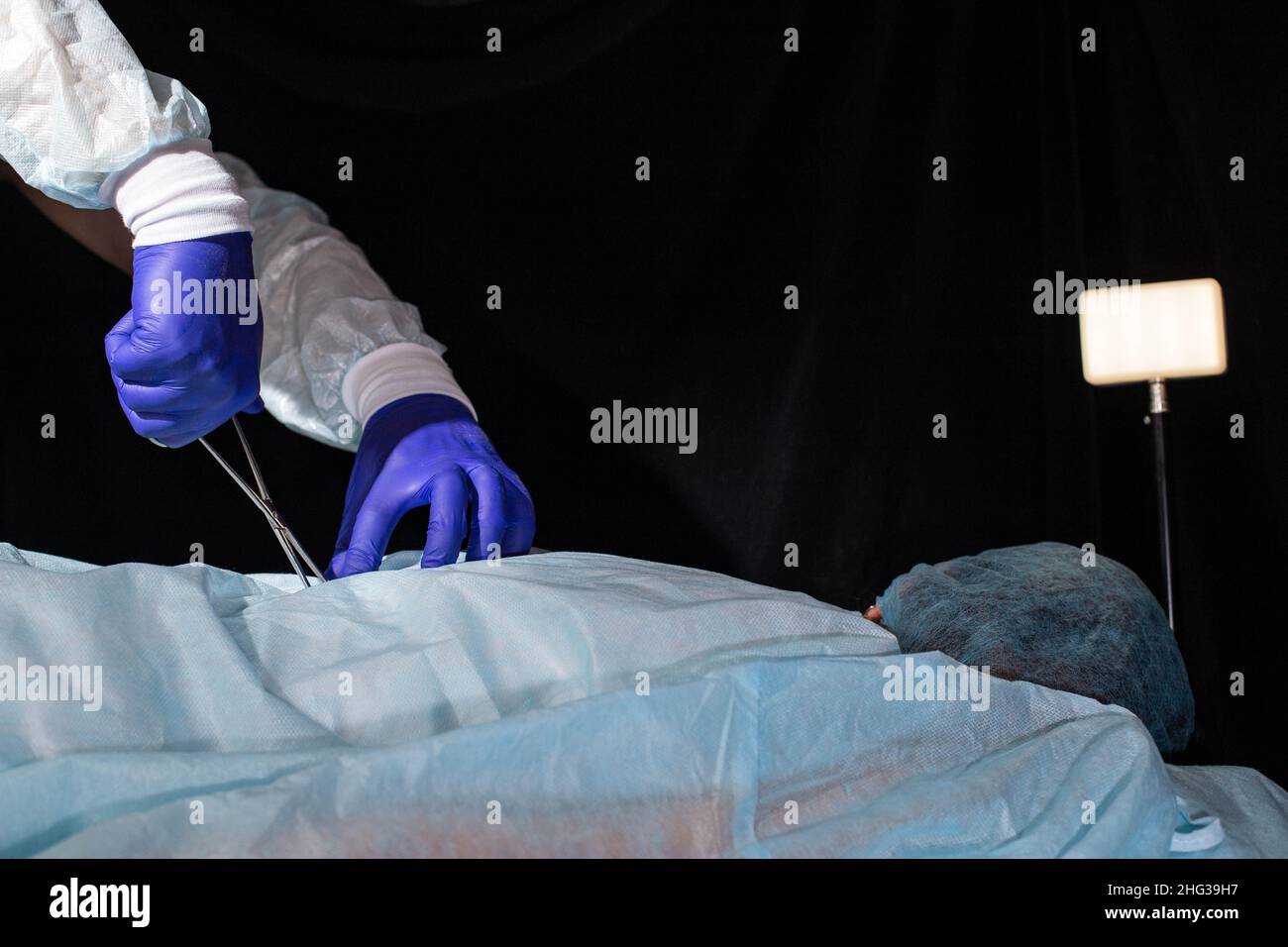 Eitriger abszess -Fotos und -Bildmaterial in hoher Auflösung – Alamy