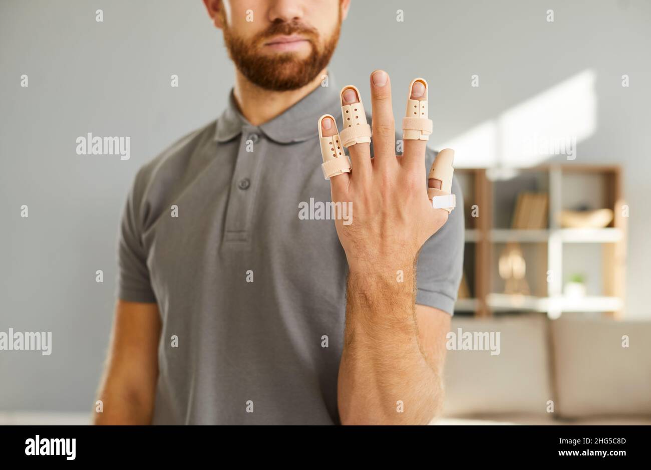 Woran Erkennt Man Einen Gebrochenen Finger www.alamy.de