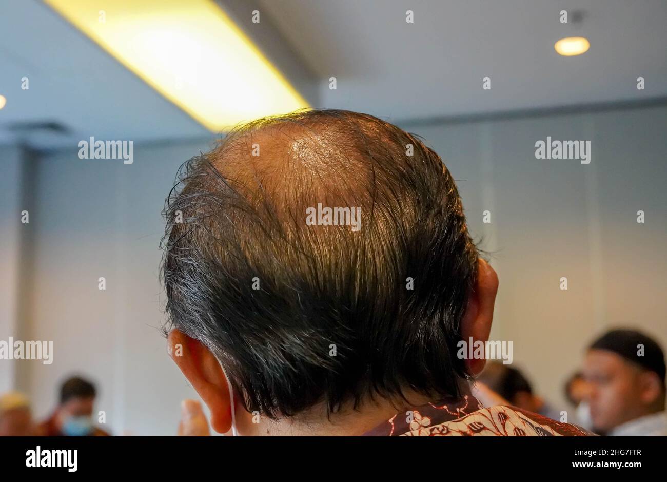 Reifer Mann, gesehen von hinten in den Kopf, um Haare zu verlieren beginnt, beginnt er zu alt zu sein. Stockfoto