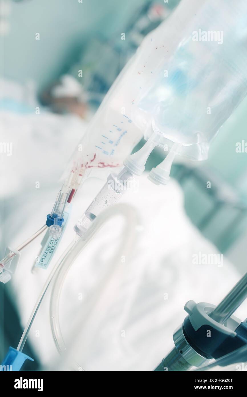 Transfusion von Blutprodukten und Infusionstherapie bei der Behandlung eines schwerkranken Patienten. Stockfoto