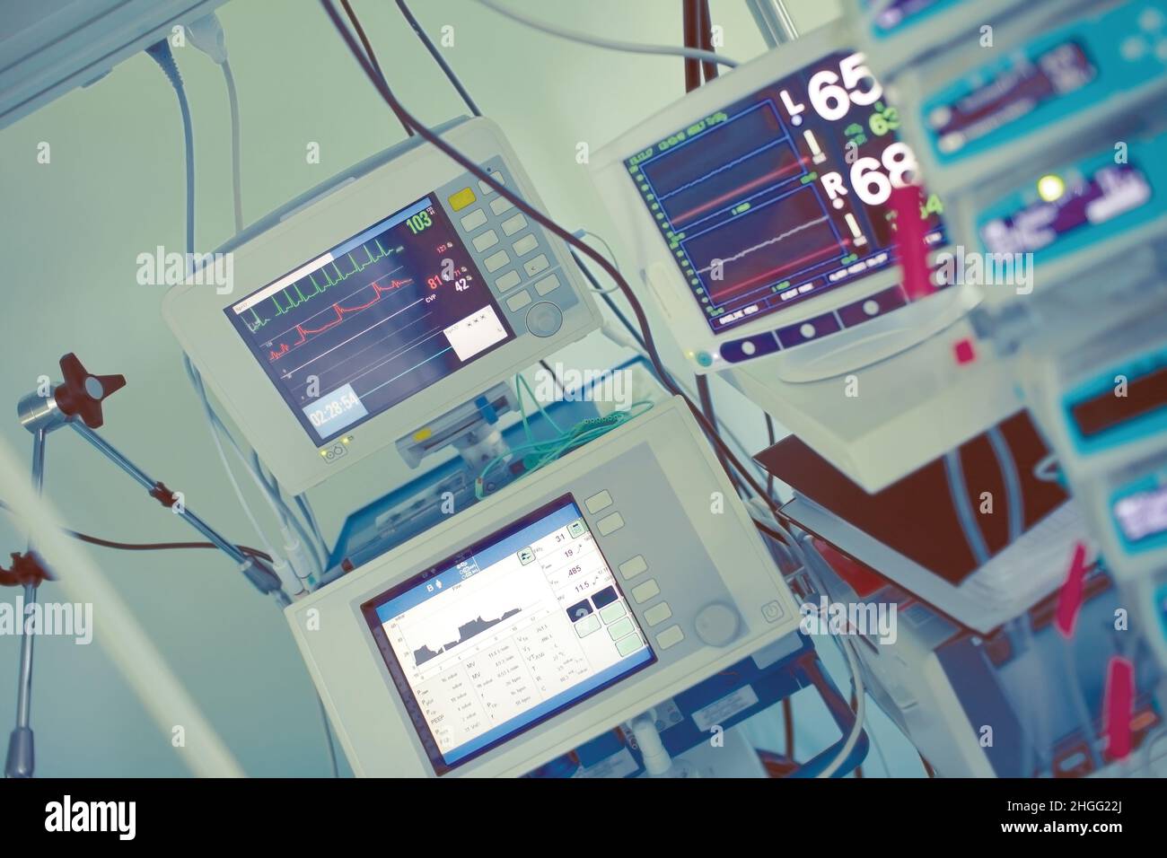 Digitale Geräte für die Herzüberwachung auf der Intensivstation. Stockfoto