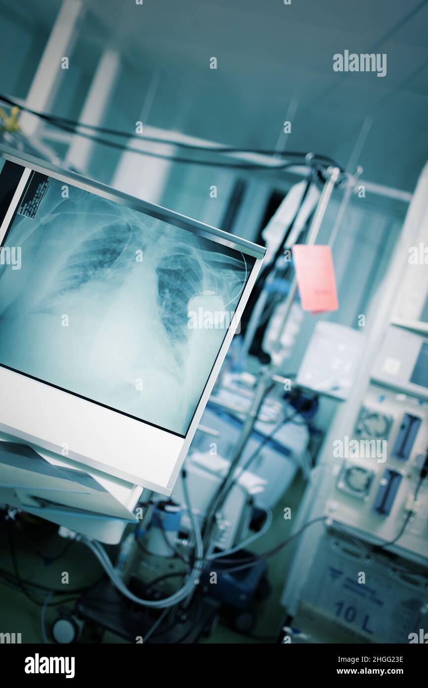 Notaufnahme mit Patient im Bett, umgeben von technischen Geräten und Röntgenbild des Brustkorbs. Stockfoto