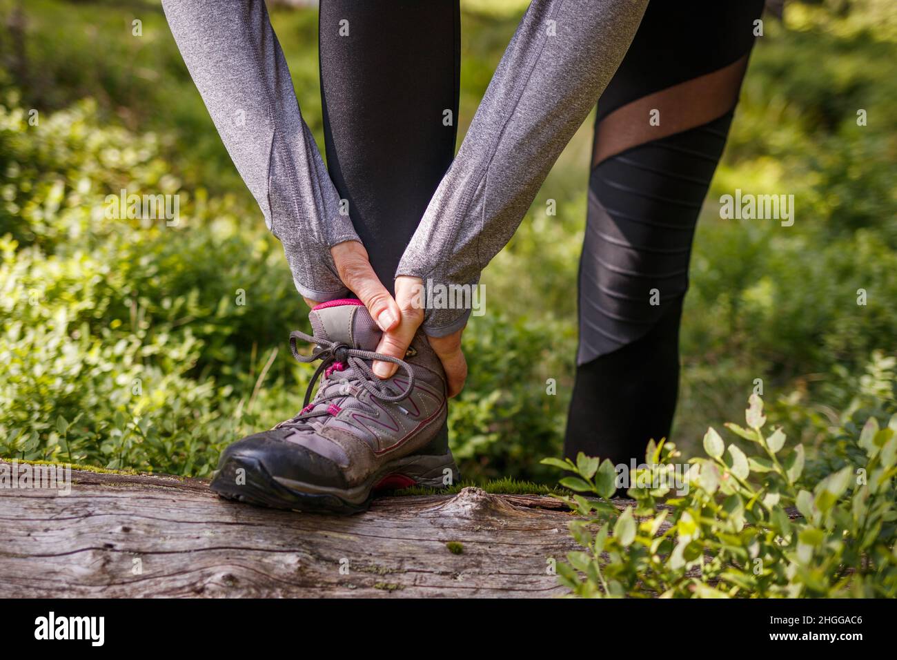 Geschwollene hand nach bruch Fotos und Bildmaterial in hoher Auflösung Alamy