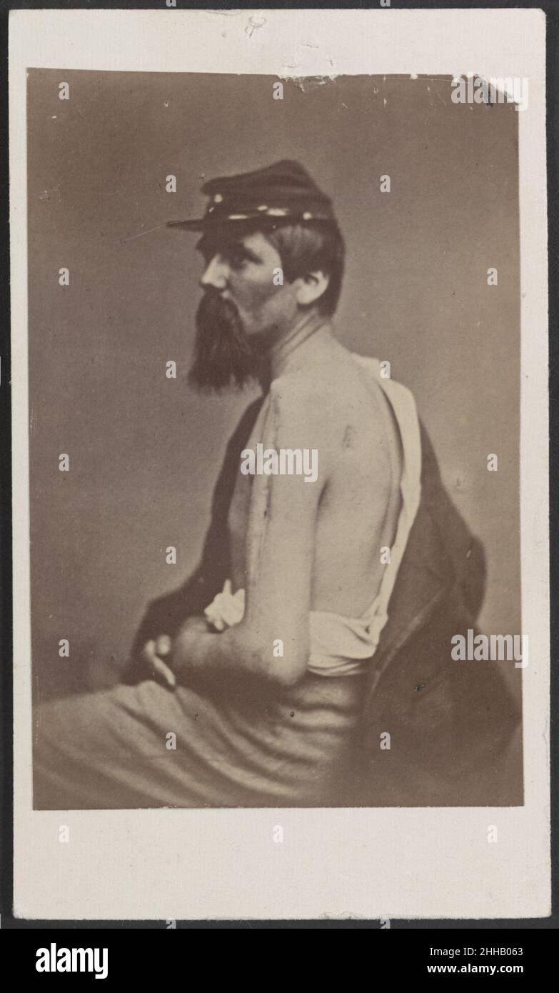 Soldat namens Ewing in Kepi mit einer Wunde am Arm) - Henry Ulke, 178 Pennsylvania Avenue, Washington, D.C. Stockfoto
