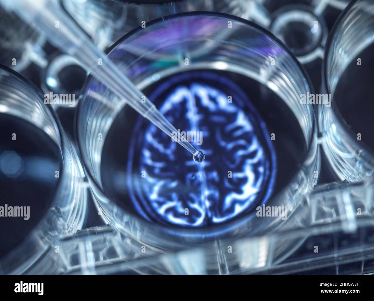 Pipettieren einer potenziellen Heilung von Gehirnerkrankungen in eine Multi-Well-Platte Stockfoto