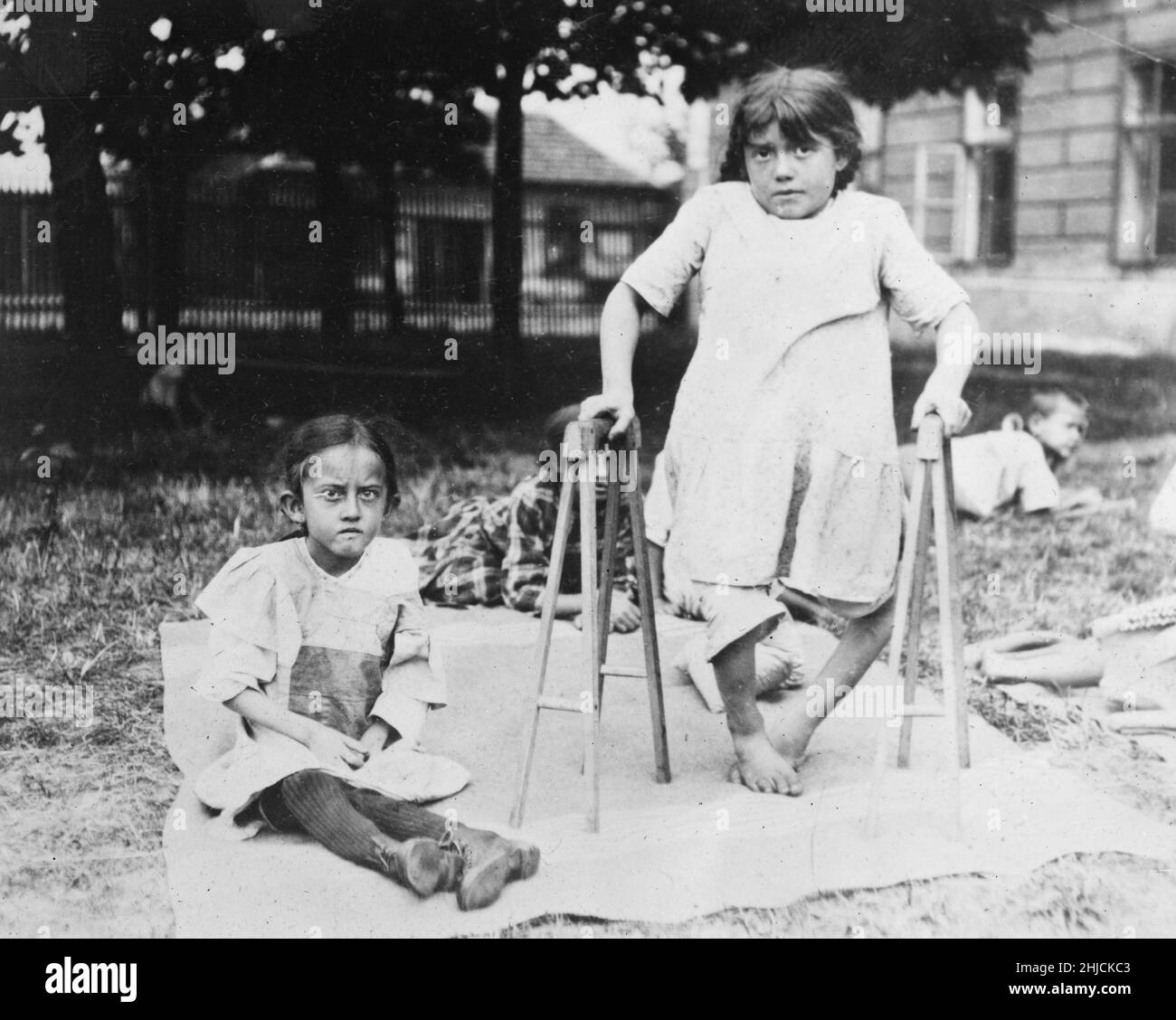 Rechts ist ein Mädchen, das durch Tuberkulose gelähmt ist, die durch Unterernährung verursacht wird; links ist ein fast blindes Mädchen, das nicht gehen kann. Europa, 1919. Stockfoto
