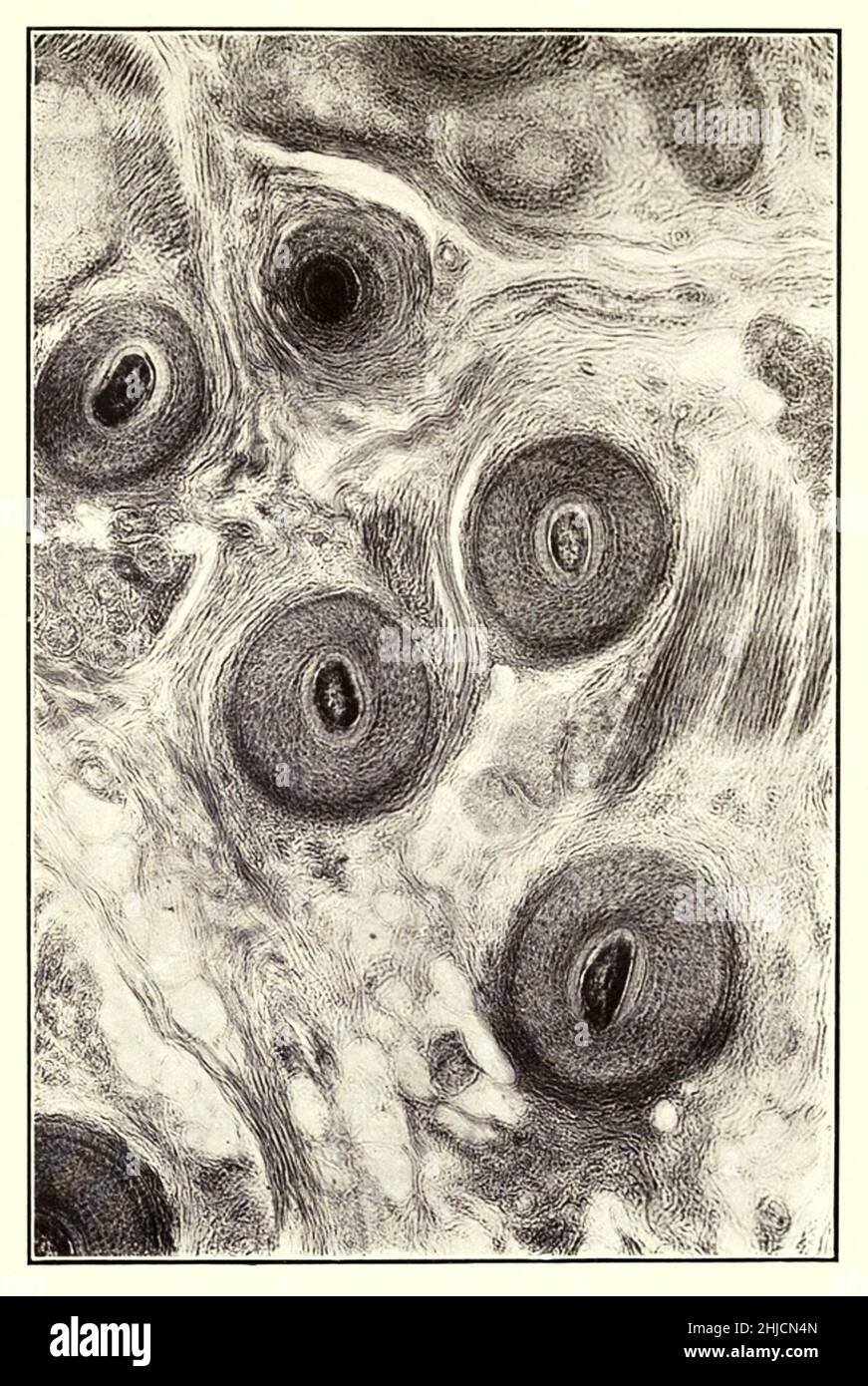 Querschnitt der menschlichen Kopfhaut. Vergrößerung: 100x. Fotomikrograph von Arthur E Smith in den frühen 1900er Jahren, mit einem kombinierten Mikroskop und Kamera. 1904 stellte die Royal Society in London eine Reihe von Smiths Fotomikrographen der Öffentlichkeit aus. Sie wurden später 1909 in einem Buch mit dem Titel "Nature Through Microscope & Camera" veröffentlicht. Sie waren die ersten Beispiele für die Photomikroskopie, die viele je gesehen hatten. Stockfoto