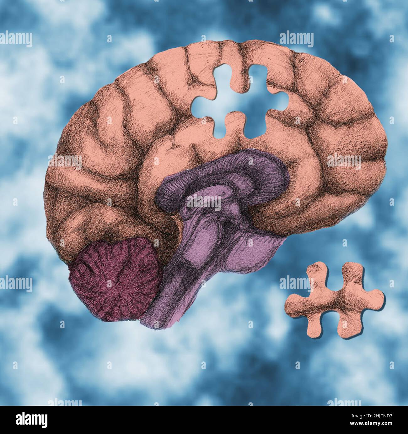 Ein konzeptuelles Bild, das ein in Wolken schwebendes Gehirn zeigt, in dem ein Puzzleteil fehlt, das zur Veranschaulichung der Gehirnfunktion, der Hirnschäden, der Alzheimer-Krankheit, der Komplexität des Gehirns, des Gedächtnisverlustes, Psychische Gesundheit, Vergesslichkeit, Demenz oder die Rätsel der Neurowissenschaften. Stockfoto
