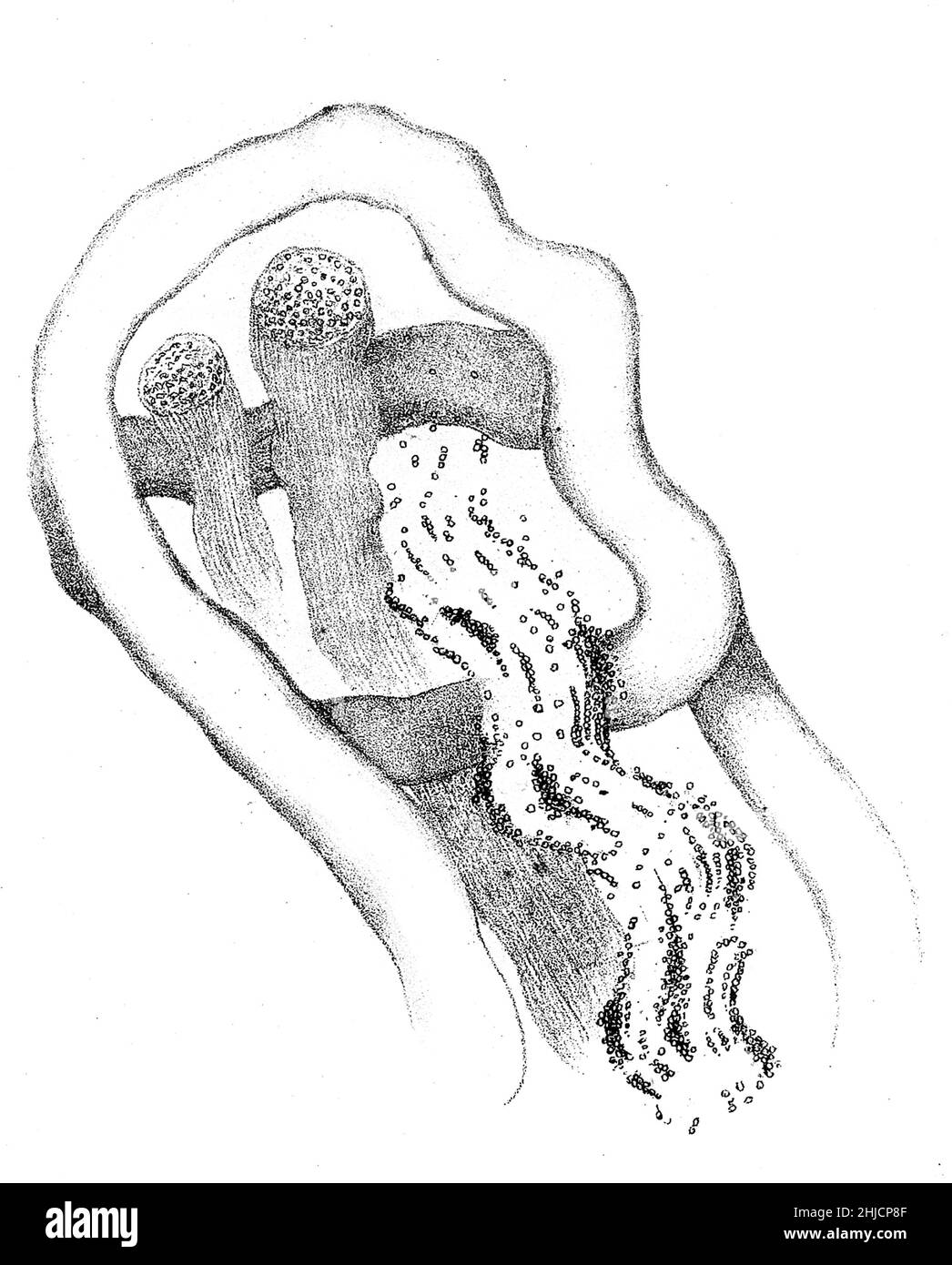 Wallersche Degeneration eines Froschnervs, drei Wochen nach Nervenschnitt. Augustus Volney Waller, 1850. Augustus Volney Waller (1816-1870) war ein britischer Neurophysiologe. Er war der erste, der die Degeneration von abgetrennten Nervenfasern beschrieb, die heute als wallerische Degeneration bekannt ist. Stockfoto