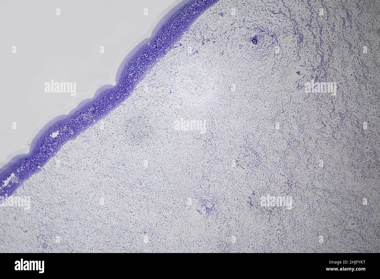 Staphylococcus epidermis unter einem Lichtmikroskop Stockfoto