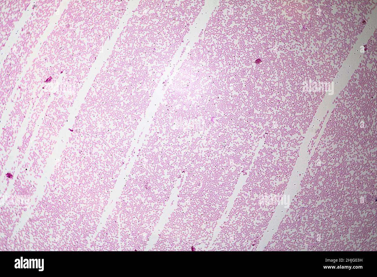 Trypanosoma gefärbt, wie durch ein Lichtmikroskop betrachtet Stockfoto