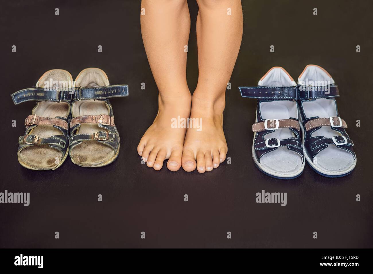 Orthopädische der Alten und Neuen Kinder Schuhe. Thomas Heel, Arch Support Stockfoto