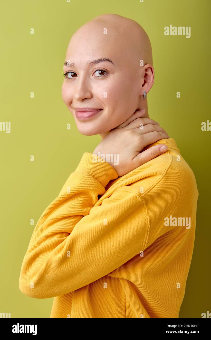 Porträt der jungen kaukasischen Glatze Dame isoliert auf grünem Studio-Hintergrund. Schönes weibliches Model in gelbem Casual Shirt, lachend. Menschliche Emotionen, fa Stockfoto