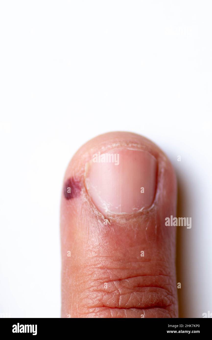 Zehen, Hände Finger und Nägel. Männliche menschliche Körperteile 20 bis 30 Jahre alt 24Mpx Bild Stockfoto
