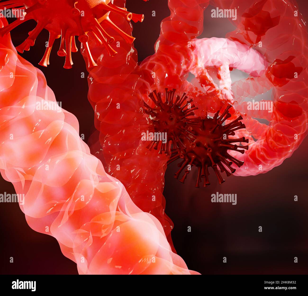 Infektion des Covid-19-Virus in der DNA, pandemische Grippekrankheiten des Coronavirus Stockfoto