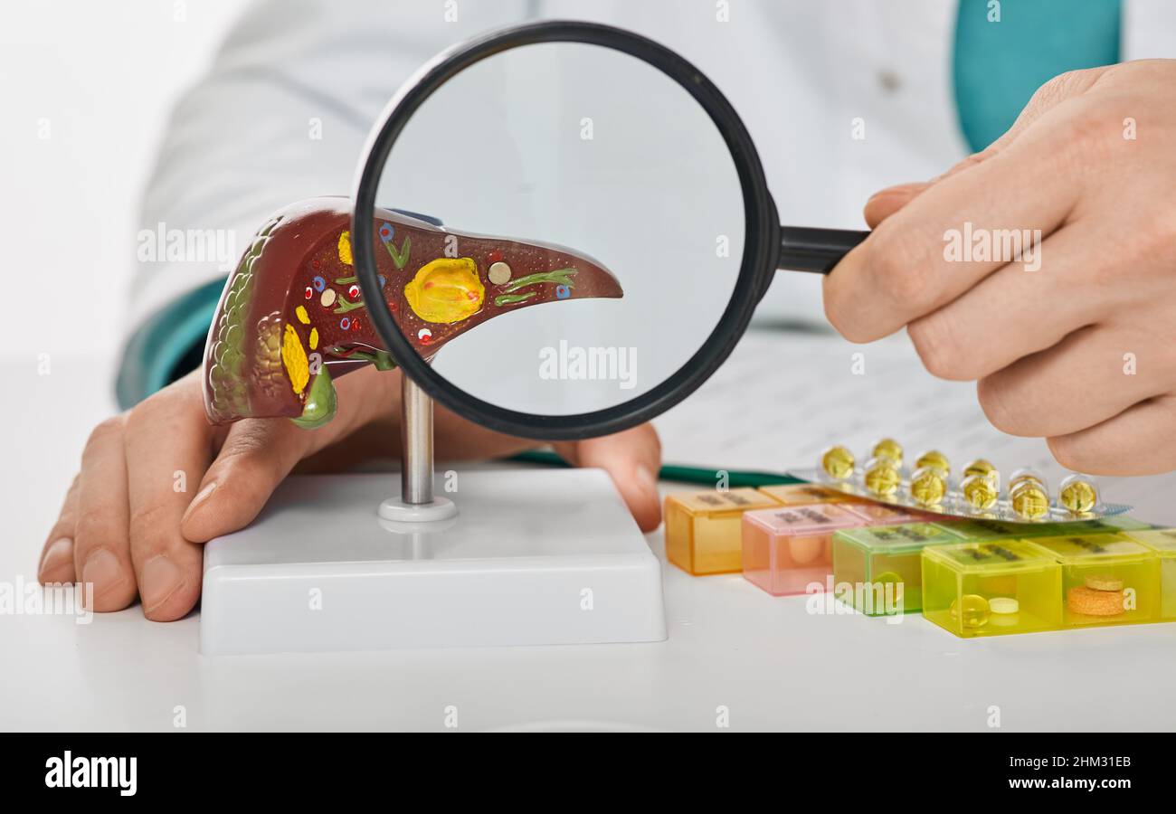 Lebererkrankungen beim Menschen, Diagnostik und Leberbehandlung. Arzt zeigt ein anatomisches Lebermodell zur Behandlung von Hepatitis, Zirrhose und Krebs Stockfoto