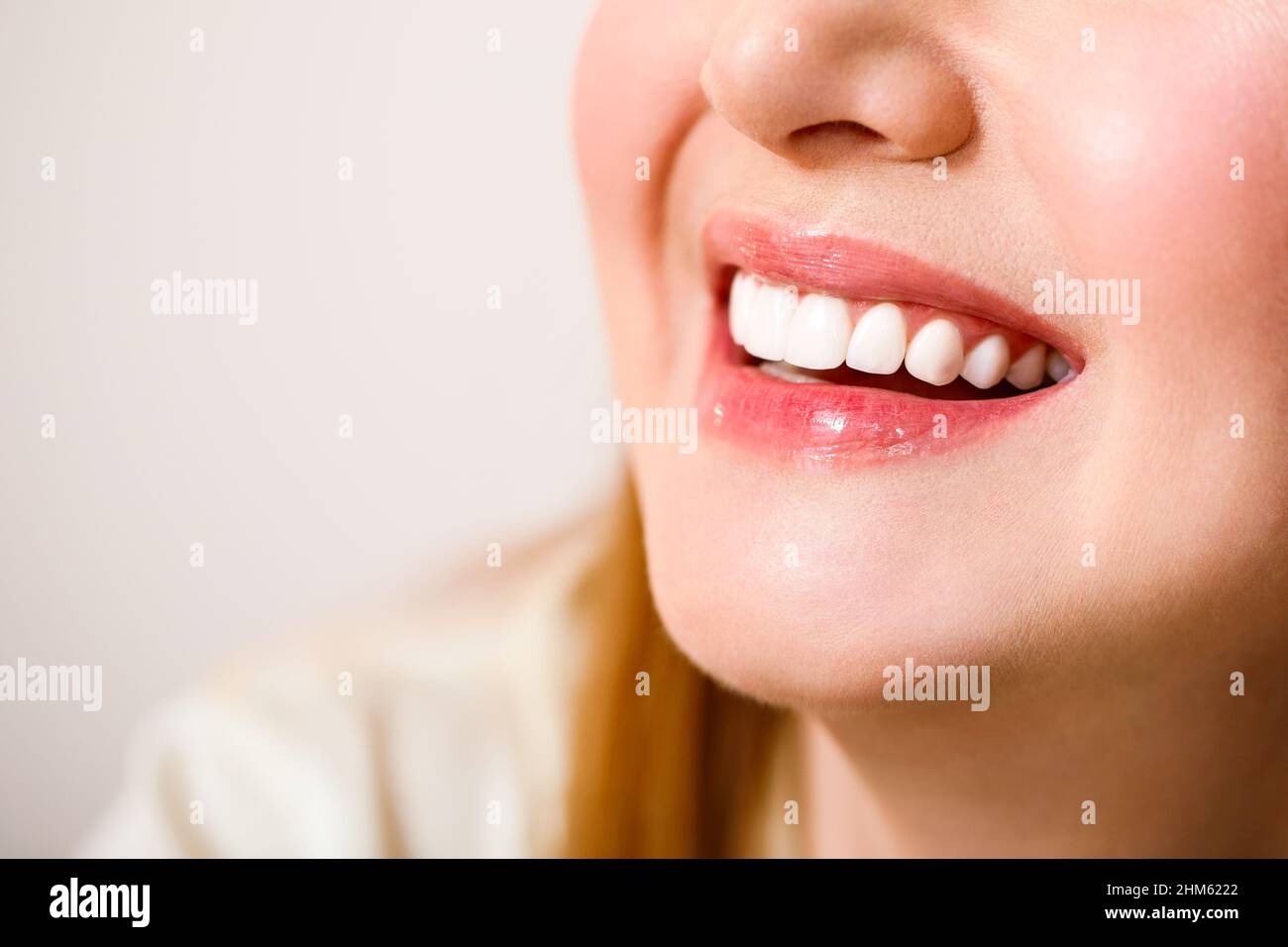 Schönes weibliches Lächeln nach Zahnaufhellung Verfahren. Zahnpflege. Zahnmedizin Konzept. Auf blauem Hintergrund. Stockfoto