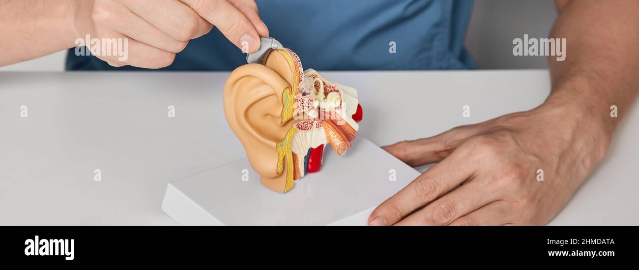 Behandlung von Gehörlosigkeit bei Hörgeschädigten mit Hilfe von Hörgeräten. Hörgeräteakustiker, der das BTE-Hörgerät an das anatomische Modell des Ohrs einführt Stockfoto