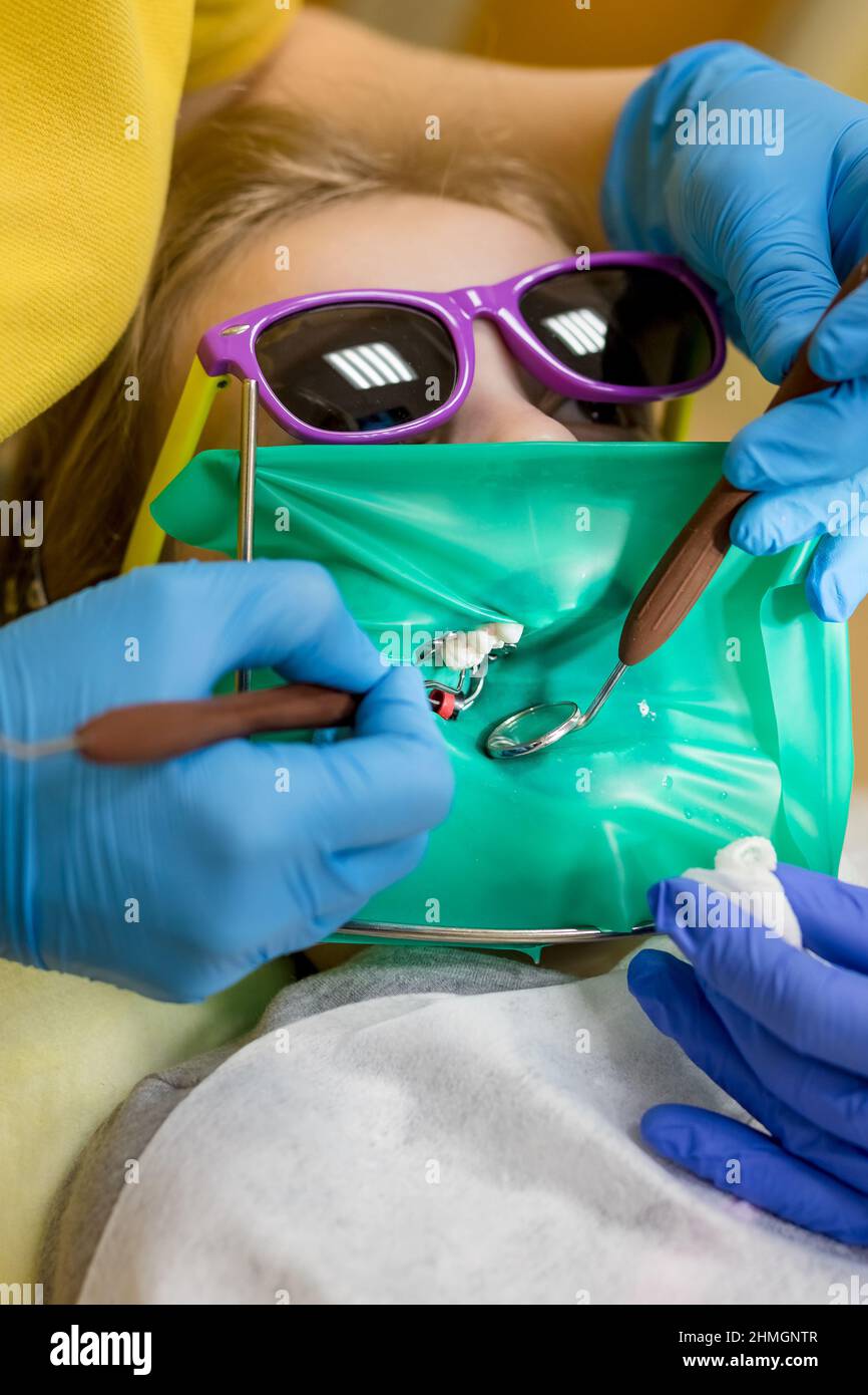 Ein kleines Mädchen mit einem Munddilatator bei der Zahnarztverabreichung. Behandlung und