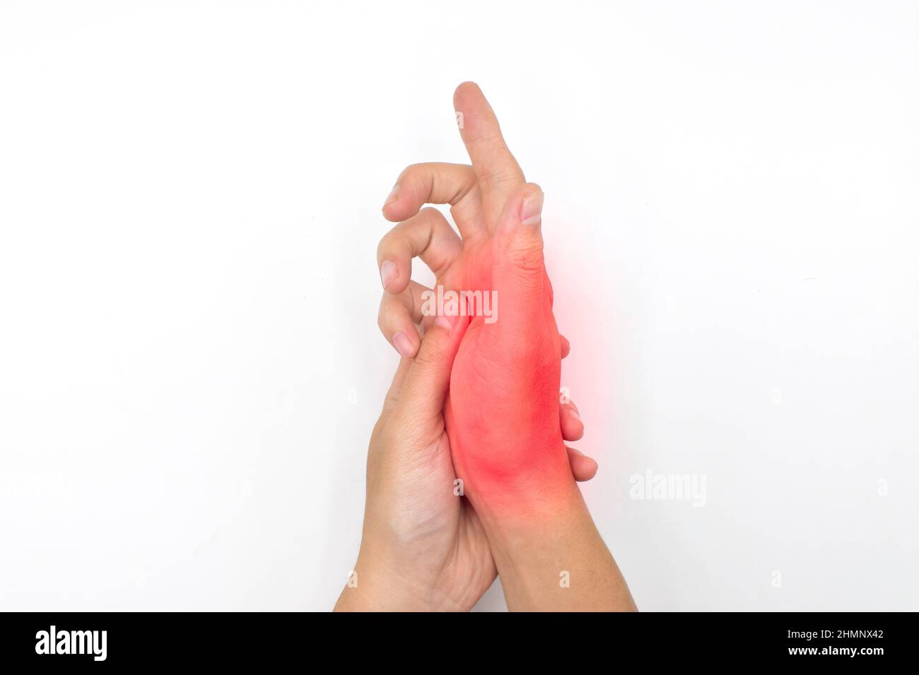 Schmerzhafter Palmar-Aspekt des asiatischen jungen Mannes. Konzept des Kompartiment-Syndroms, Zellulitis und Schmerzen der Handmuskulatur. Stockfoto