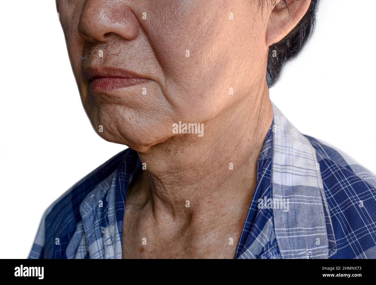 Alternde Hautfalten oder Hautfalten oder Falten des südostasiatischen, chinesischen alten Mannes. Stockfoto