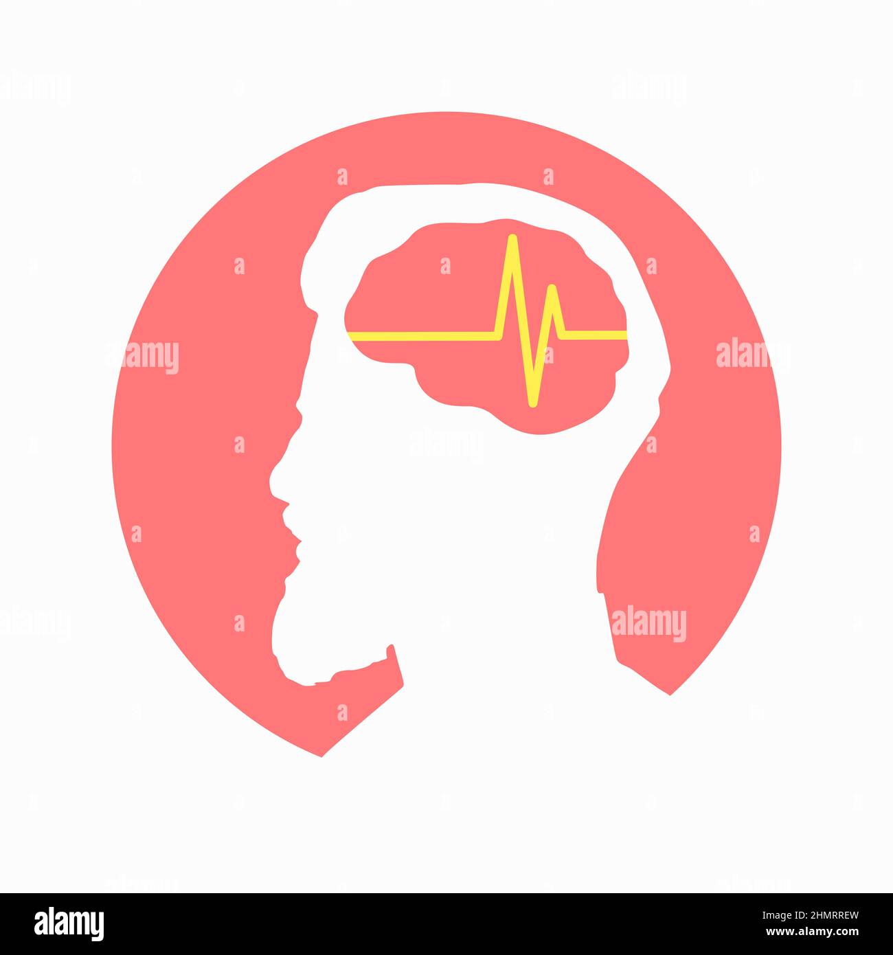 Illustration des medizinischen Vektor-Symbols für die Gehirnenzephälographie auf dem menschlichen Kopf, isoliert auf weißem Hintergrund. Schlaganfall, Epilepsie und Alzheimer-Bewusstsein Stock Vektor