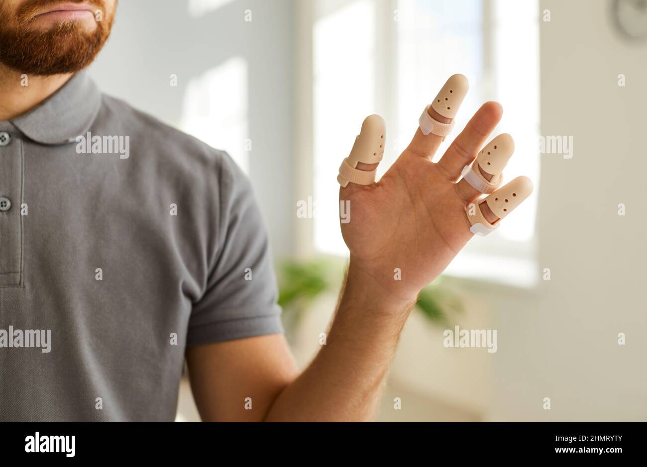 Nahaufnahme der Hand eines Mannes mit verstellbaren Schienen an verletzten oder gebrochenen Fingern. Stockfoto