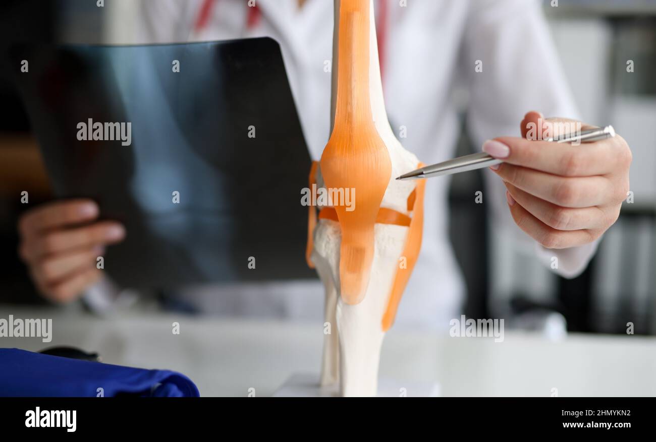 Arzt mit Röntgenaufnahme in den Händen, die die Struktur des Kniegelenks auf einer künstlichen Nahaufnahme zeigt Stockfoto