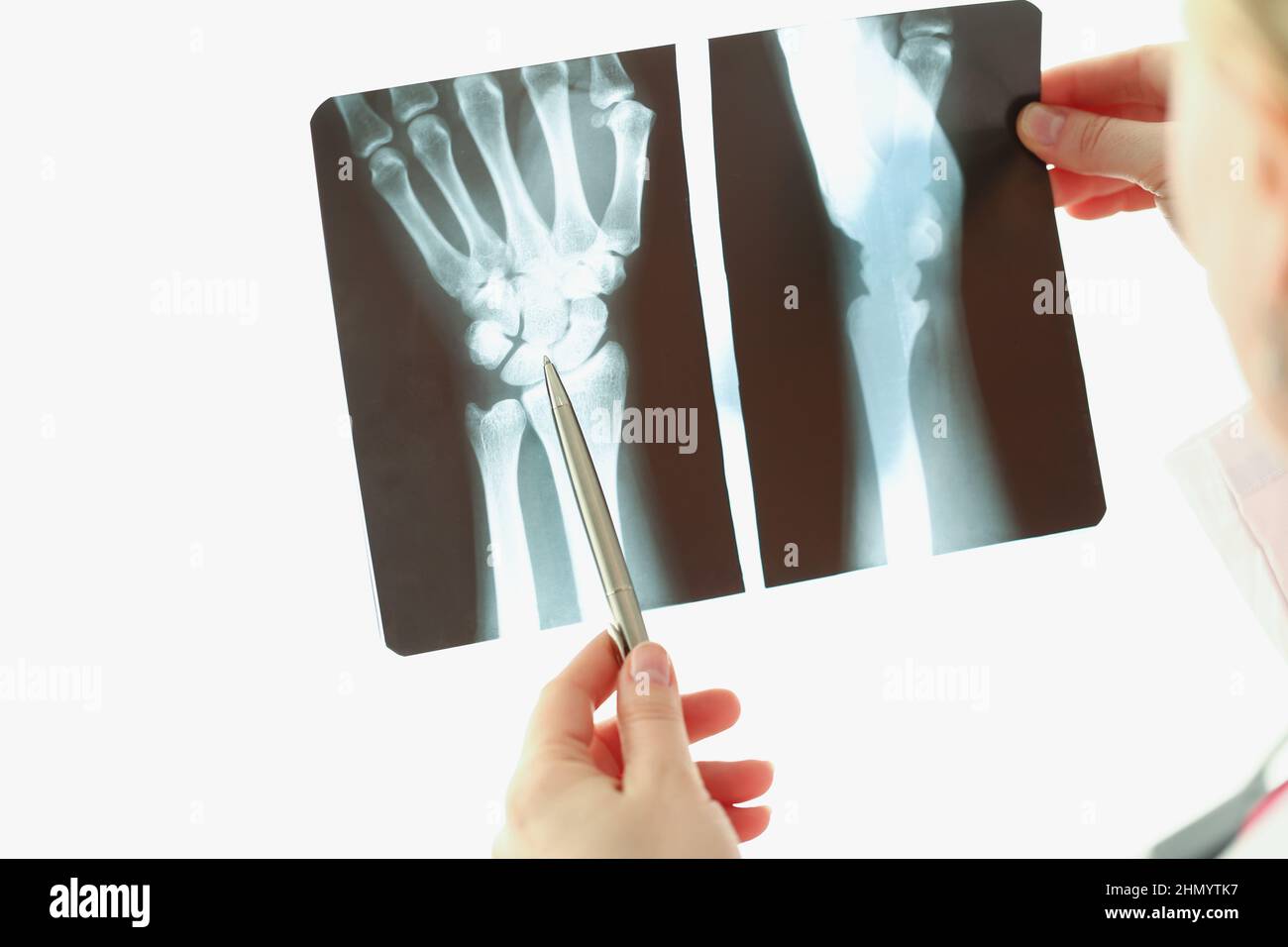 Medizinisches Personal untersucht das Ergebnis der Hand-Röntgenaufnahme des Patienten auf Licht Stockfoto