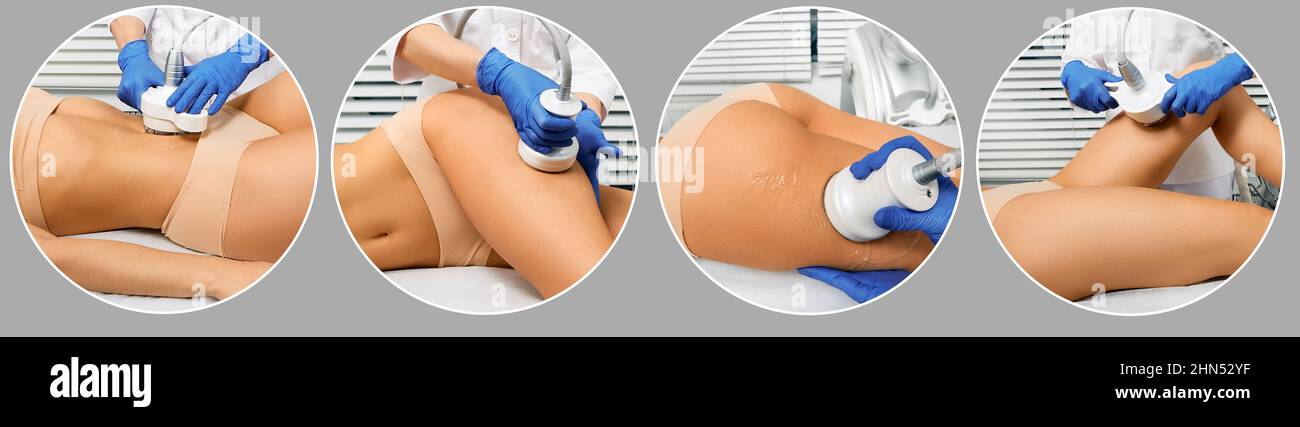 Kavitation des menschlichen Körpers in der Kosmetologie, Set. Ultraschall Kavitation Fettabbau Verfahren Entfernen von Cellulite auf weiblichen Bauch, Beine und Gesäß für schlank Stockfoto