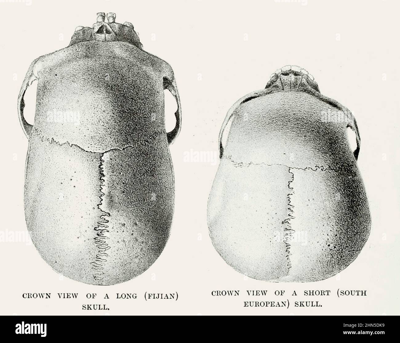 KRONANSICHT EINES KURZEN (SÜDEUROPÄISCHEN) [rechts] SCHÄDELS vs. Eines LANGEN (FIDSCHIANISCHEN) SCHÄDELS [links] aus den lebenden Rassen der Menschheit : Eine populäre illustrierte Darstellung der Bräuche, Gewohnheiten, Verfolgungen, Feste und Zeremonien der Menschenrassen in der ganzen Welt Band 1 von Sir Harry Hamilton Johnston, Henry Neville Hutchinson, Richard Lydekker und Dr. A. H. Keane veröffentlichte London : Hutchinson & Co. 1902 Stockfoto